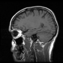 brain radiography brain radiography